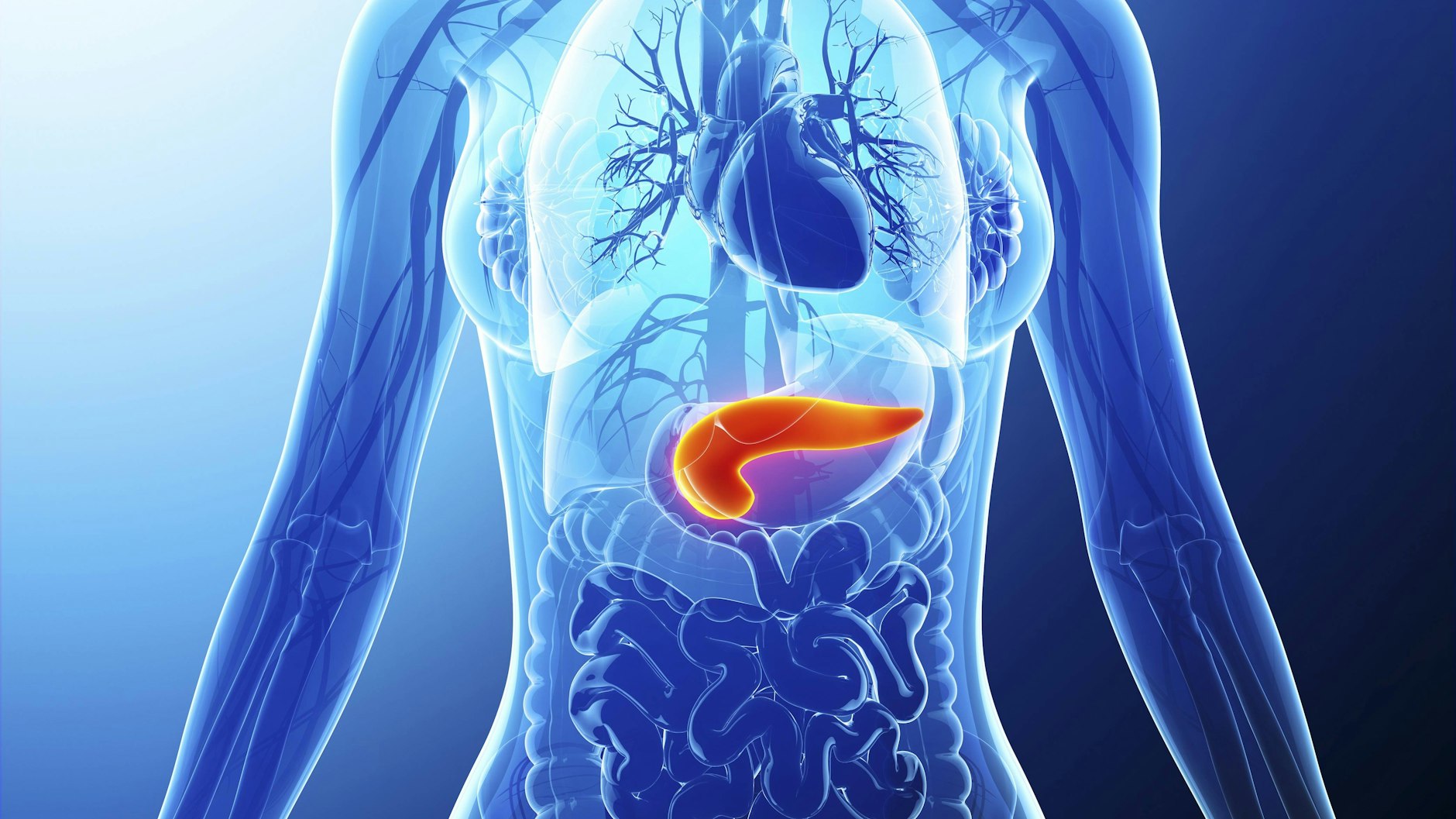 Die Bauchspeicheldrüse ( produziert Insulin.  Übergewicht und Bewegungsmangel vermindern die Wirkung des Insulins im Körper, Diabetes droht.