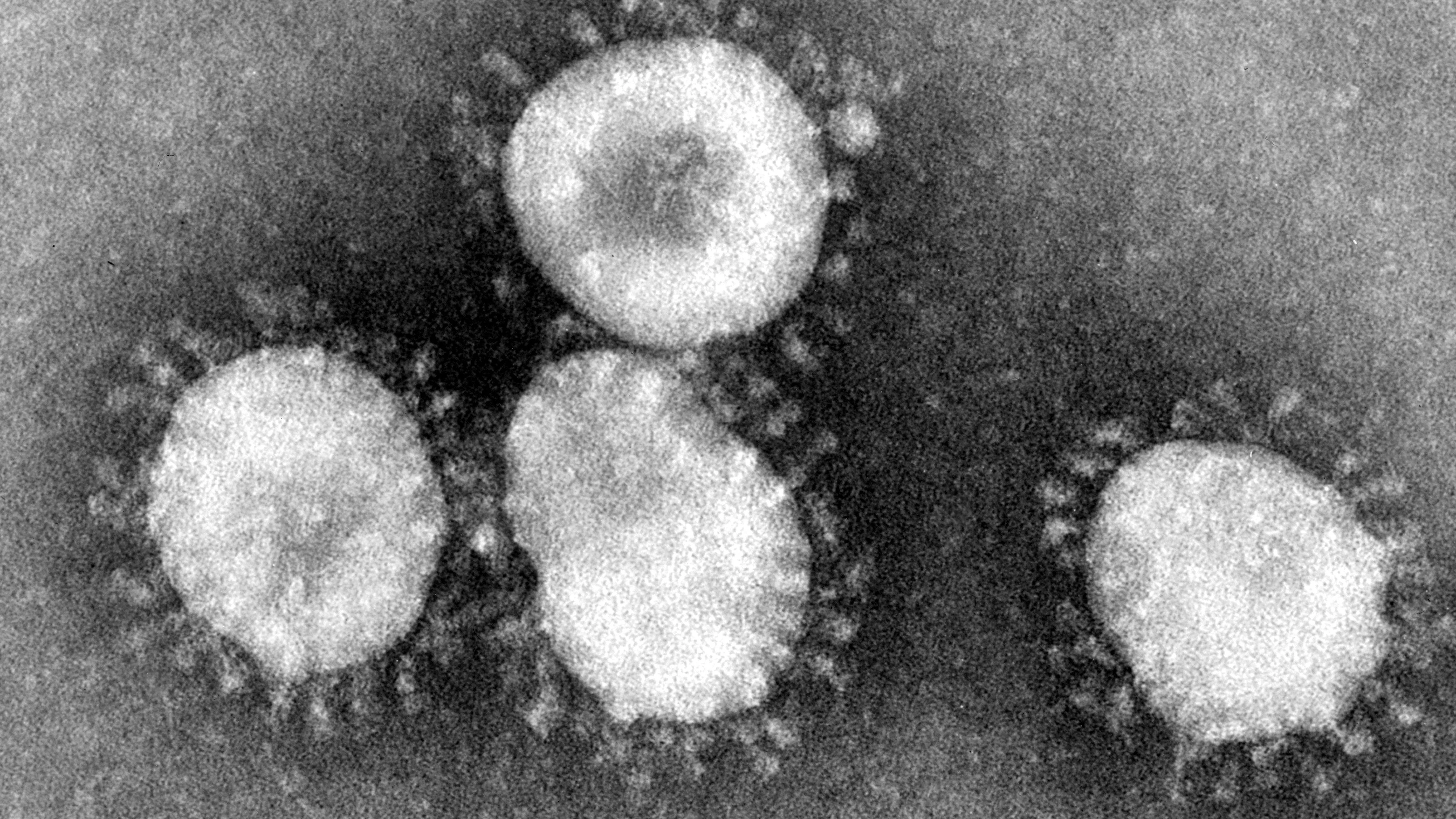 Das Coronavirus unter dem Mikroskop:&nbsp;Die Ausbreitung einer mysteriösen Lungenkrankheit in der zentralchinesischen Metropole Wuhan könnte auf einen neuartigen Coronavirus zurückgehen.