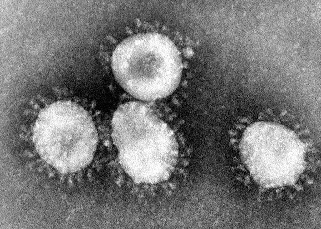 Neues Virus steckt hinter Lungenkrankheit in China