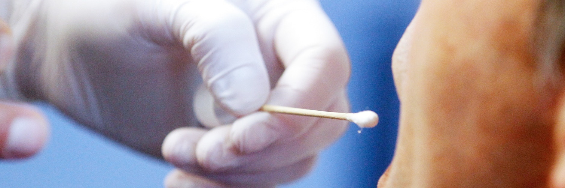 Bei 1900 Männer sollen in den nächsten Tagen Speichelproben genommen werden.