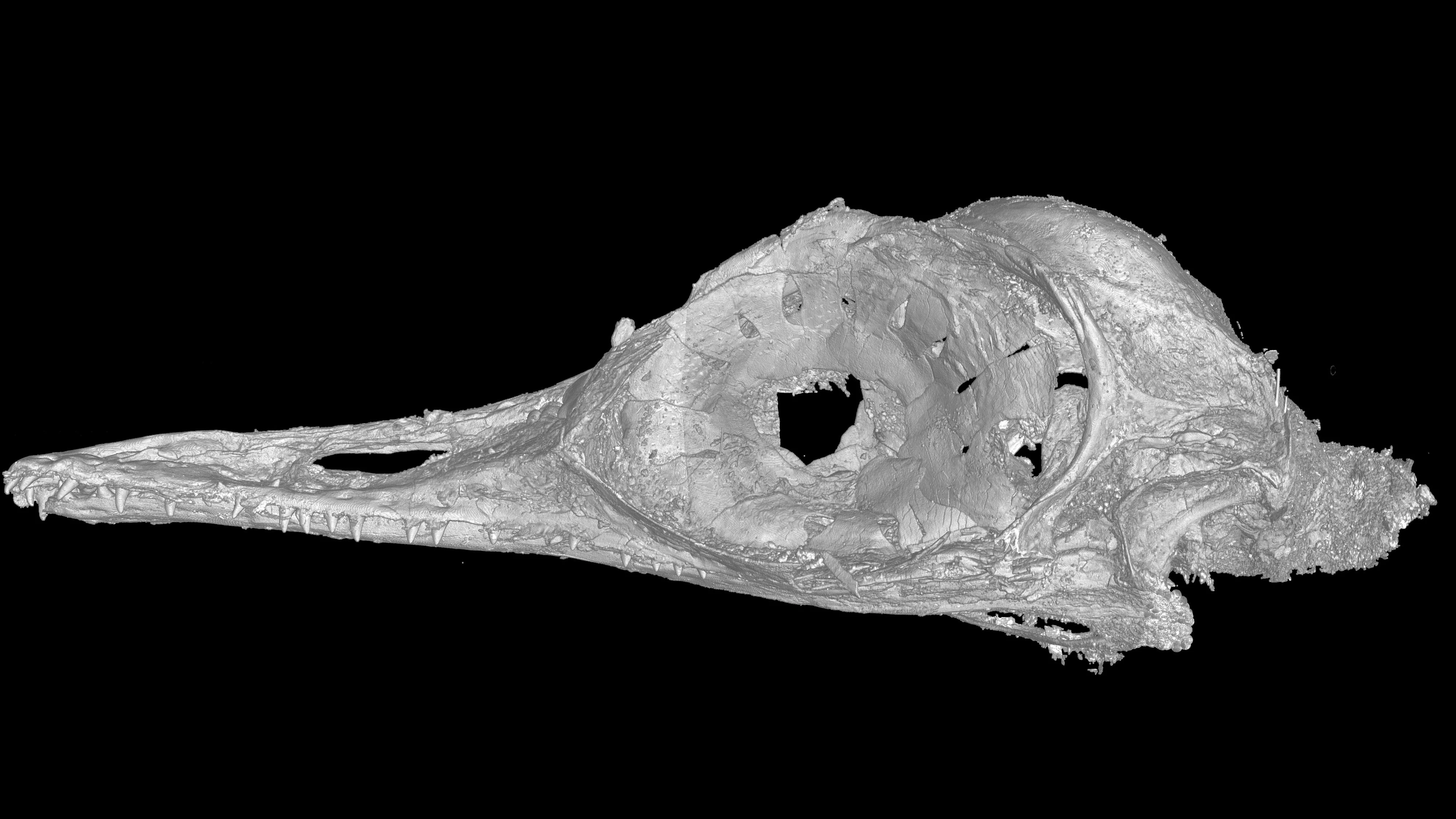 Durchleuchtet: Computertomografie-Scan des Schädels.