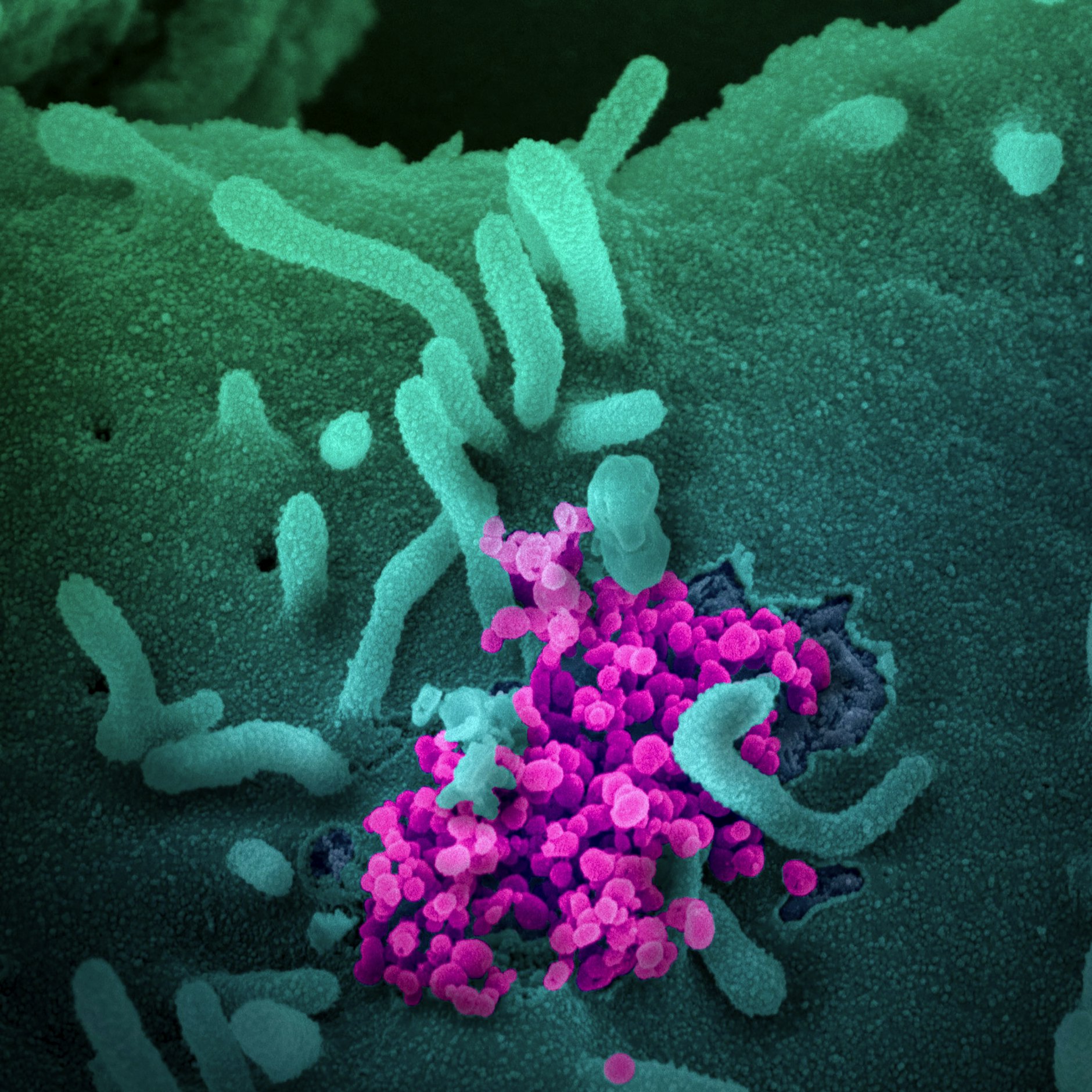 So klein und doch so wirkungsvoll. Das Virus legt Schulen in der Stadt lahm.