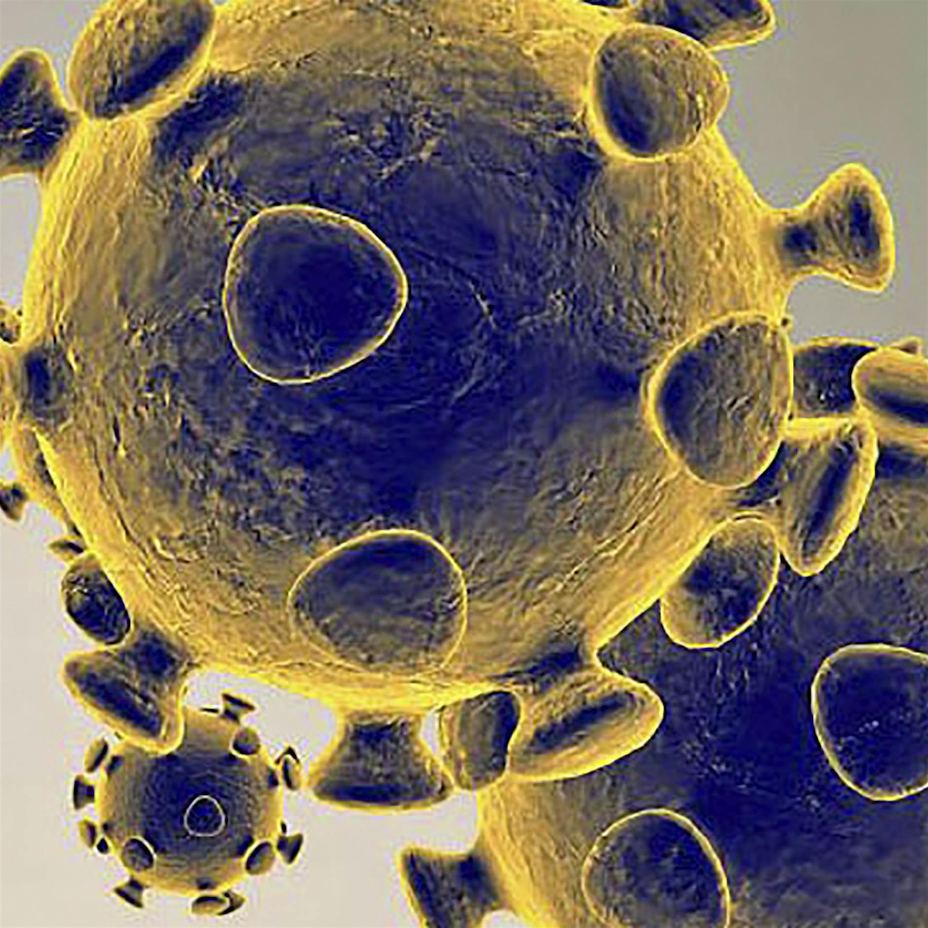 Mehrere Schulen in Berlin wegen Coronavirus geschlossen