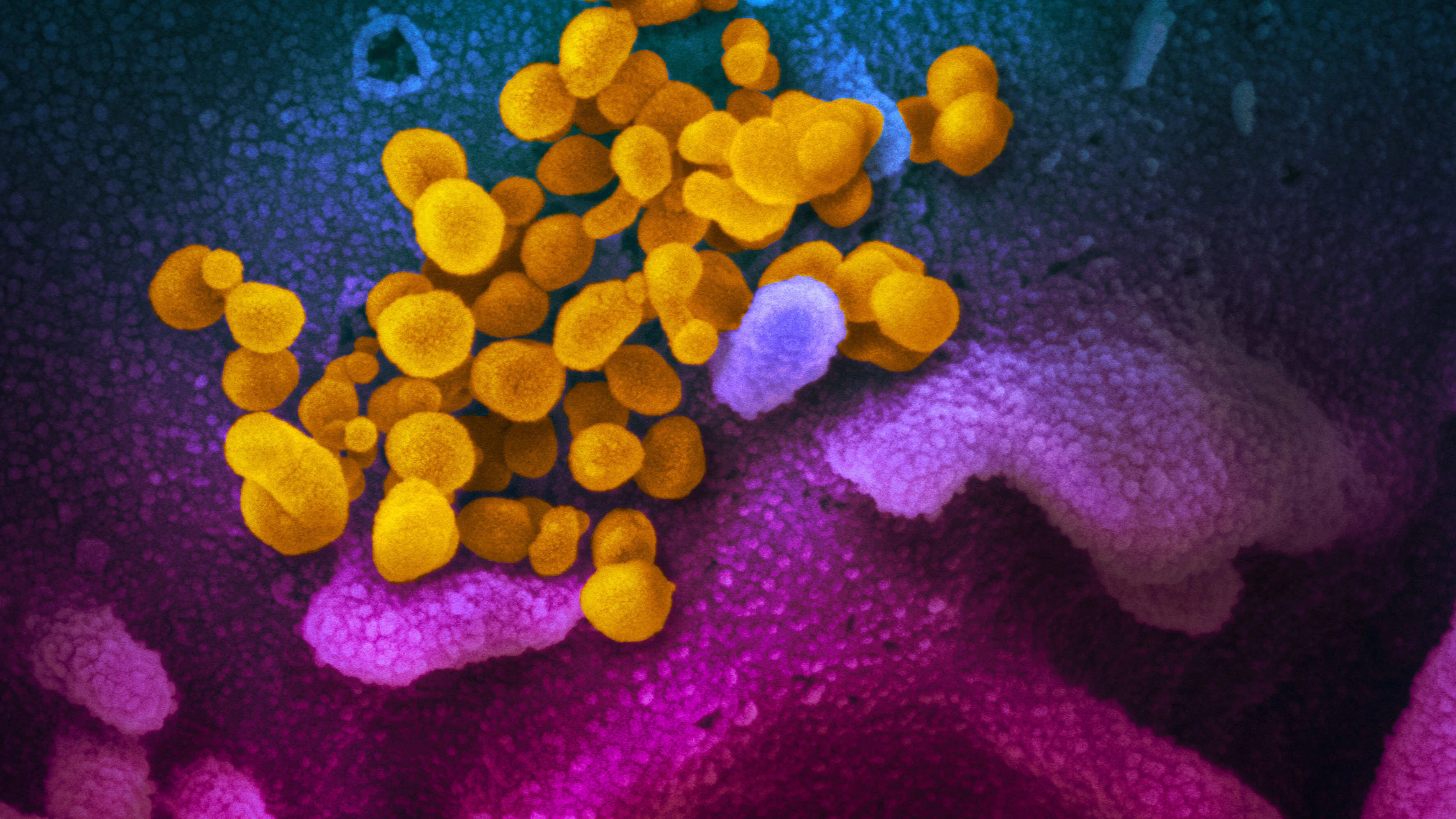 Das Coronavirus.