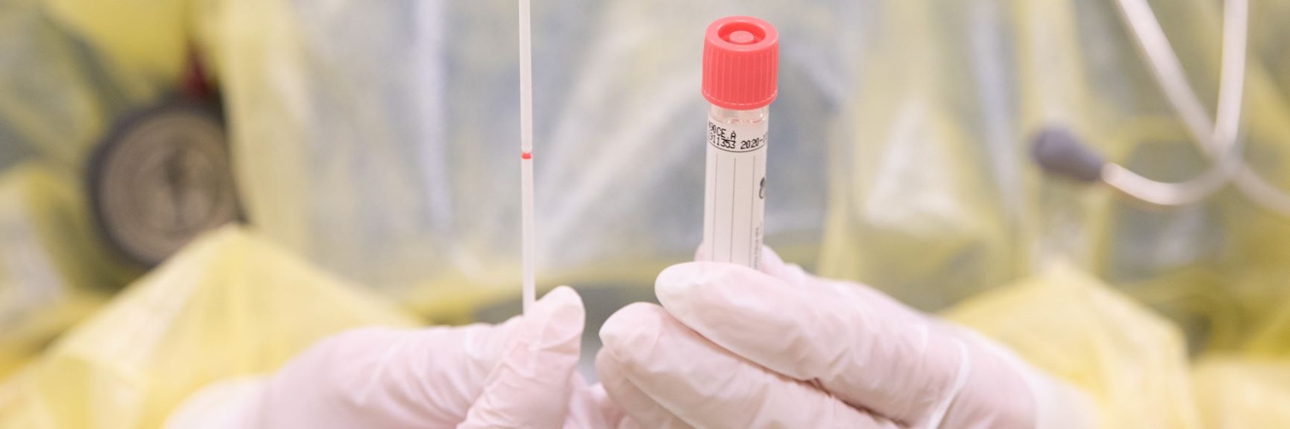 Abstrichstäbchen mit Plastikröhrchen: So sieht der gängige Corona-Test aus, der im Labor ausgewertet wird.