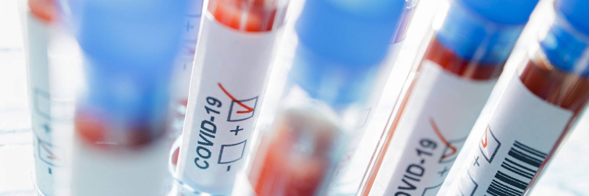 Ein Virologe der Charité spricht sich für realistischere Empfehlungen für medizinisches Personal aus.