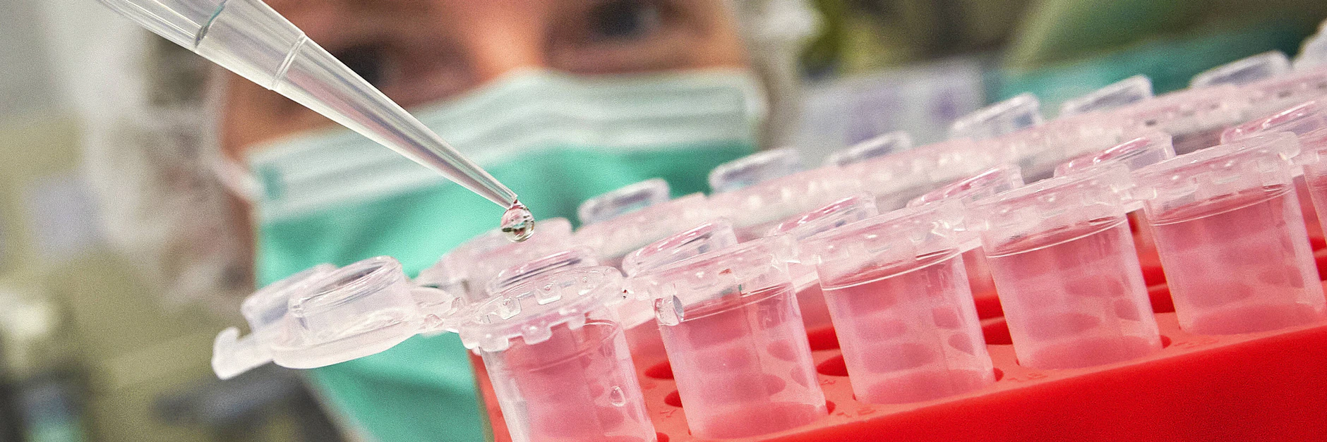 In mehr als 70 Laboren weltweit wird an der Entwicklung eines Corona-Impfstoffes geforscht.