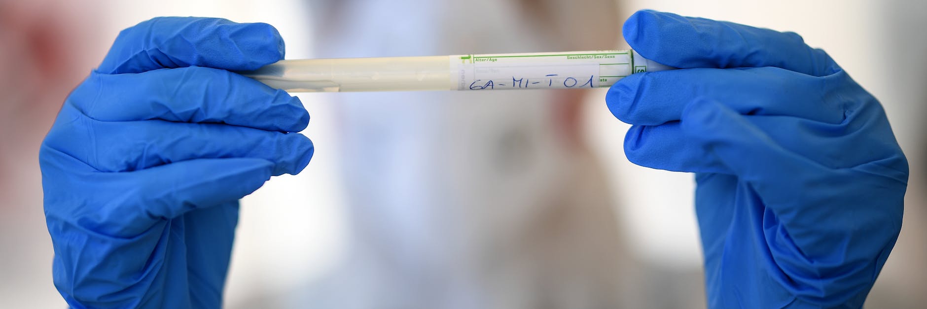 Die Corona-Krise bietet Kriminellen neue Möglichkeiten und Betätigungsfelder. Interpol warnt.