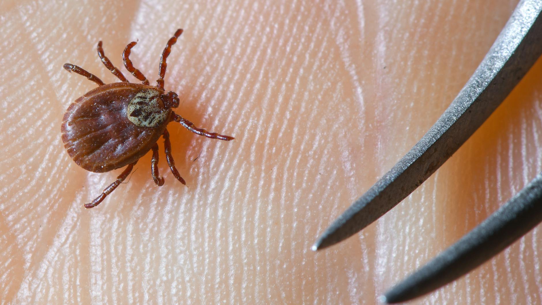 Mit einer Pinzette lassen sich Zecken gut entfernen. 