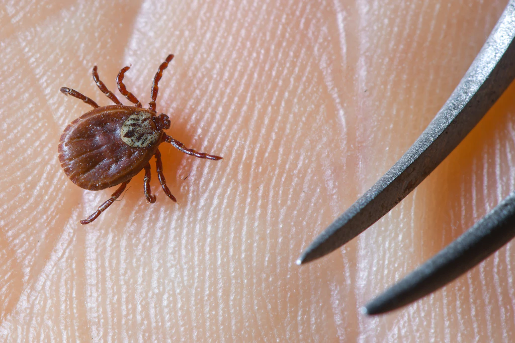 Blutsauger im Gras: Drei Tipps zum richtigen Umgang mit Zecken