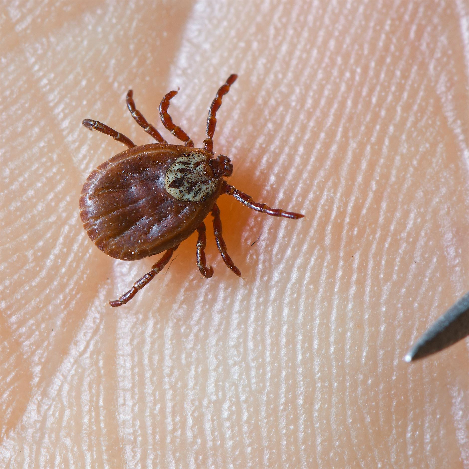 Blutsauger im Gras: Drei Tipps zum richtigen Umgang mit Zecken