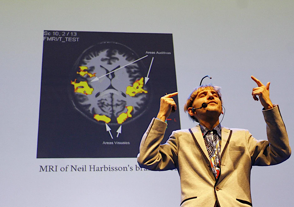 Neil Harbisson, erster offiziell anerkannter Cyborg, nutzt einen im Schädel implantierten Sensor, um Farben zu hören.