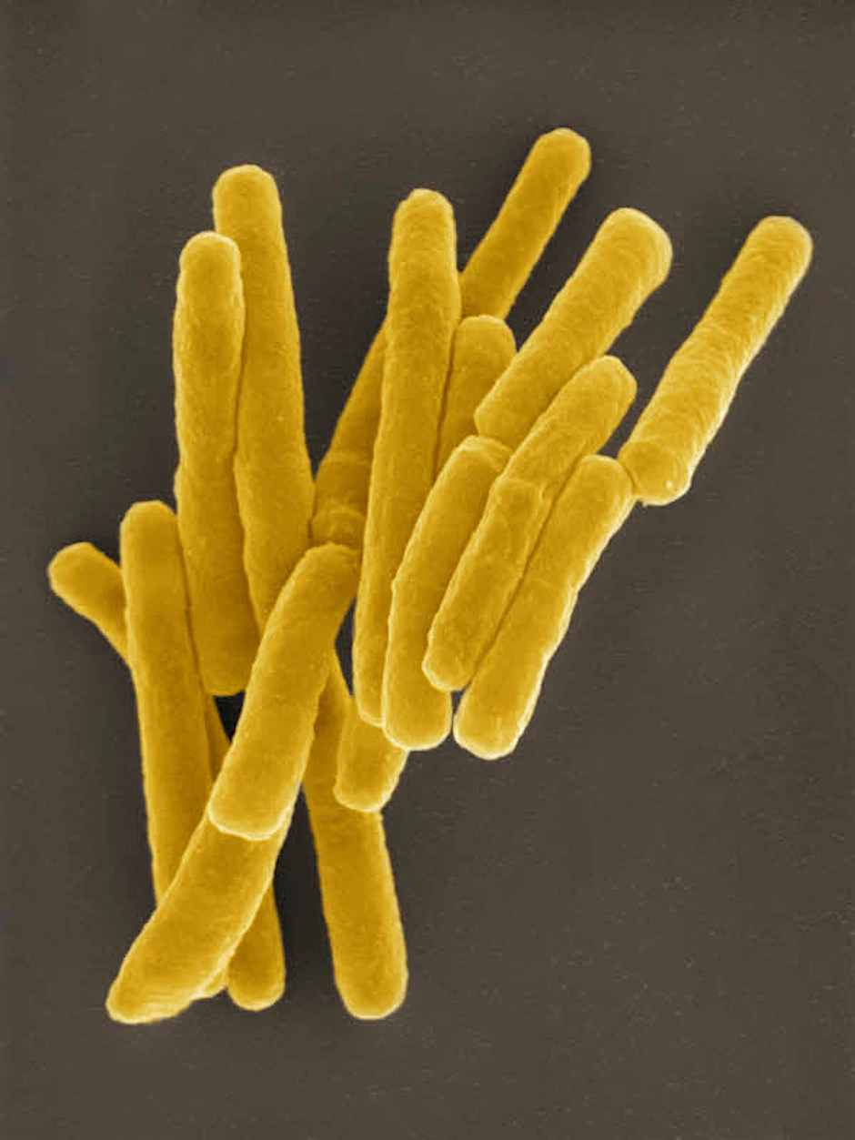 Mycobacterium tuberculosis, der Erreger der Krankheit unterm Elektronenmikroskop.