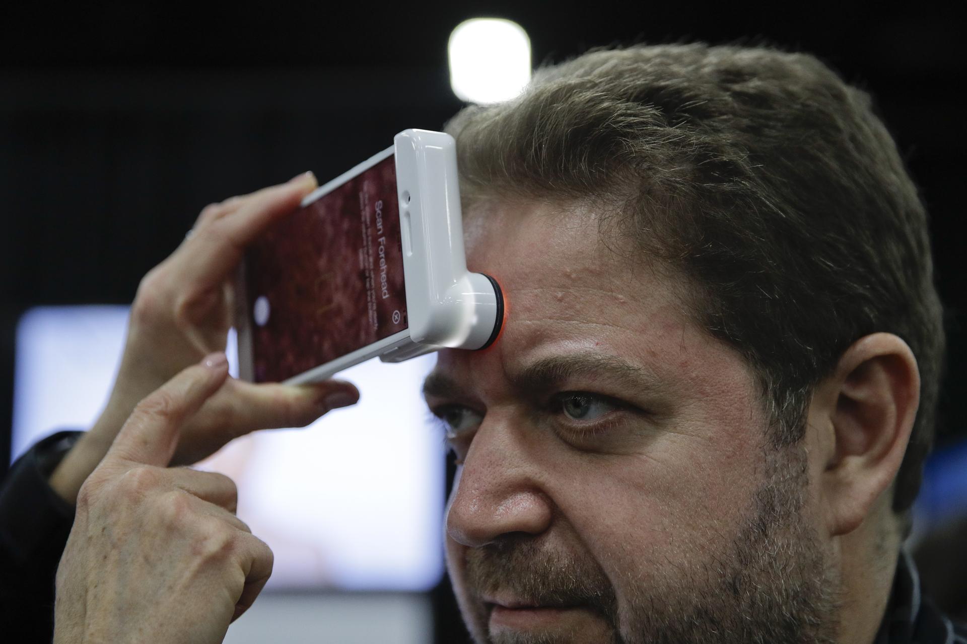 Hey, Hautanalyse gefällig? Zuerst rüstet man sein Smartphone mit der Neutrogena Skin360-App und einem extra entwickelten SkinScanner auf. Der Scanner besteht vor allem aus einer stark vergrößernden Linse, mit der Fotos von Gesicht, Stirn, Kinn und Wangen geschossen werden. Anschließend liefert die App gnadenlos Daten zur Größe der Poren, Tiefe der Falten und dem Feuchtigkeitsgehalt der Haut.