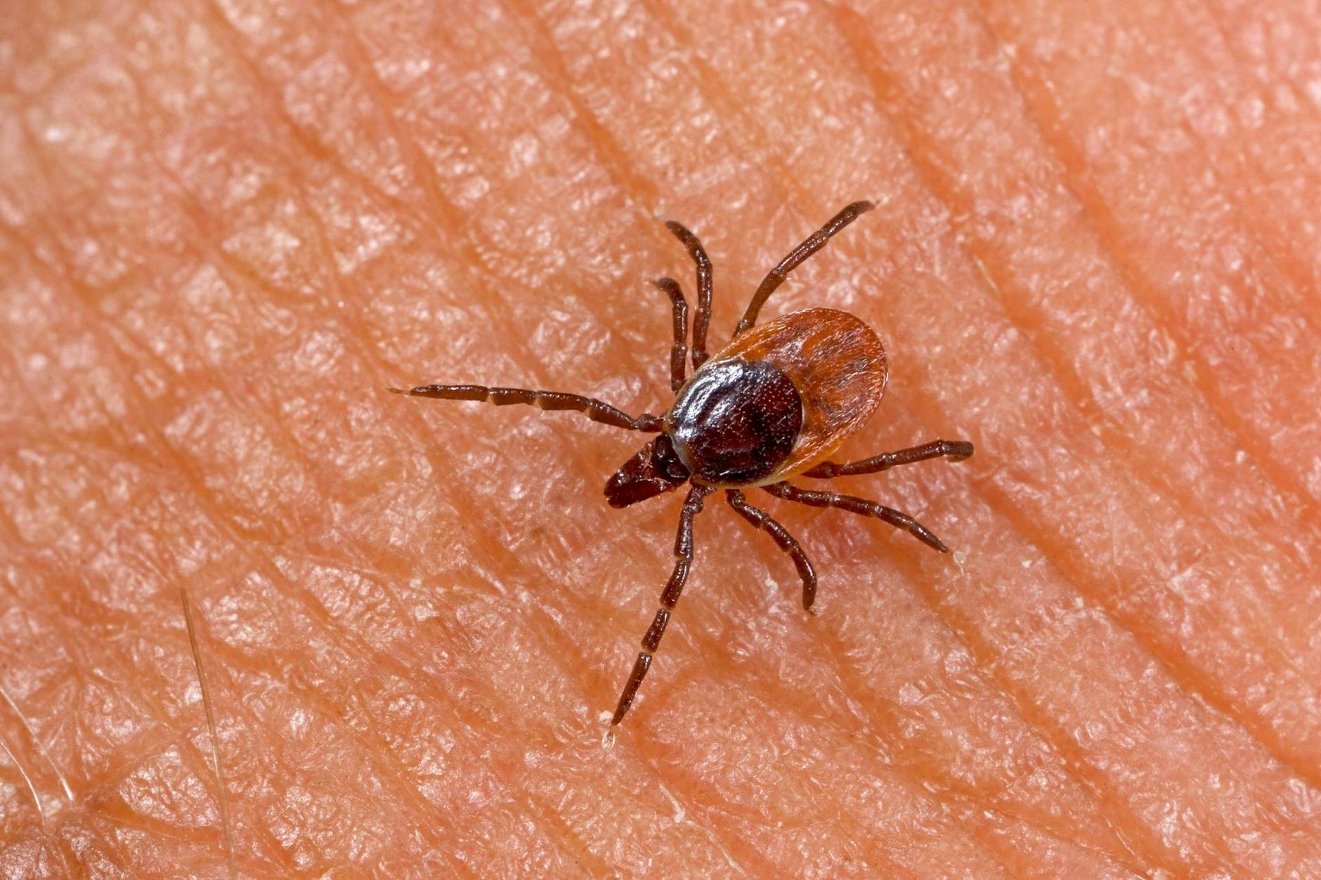 Bildet sich nach einem Zeckenstich eine kreisrunde Rötung, sollte man schleunigst einen Arzt aufsuchen.