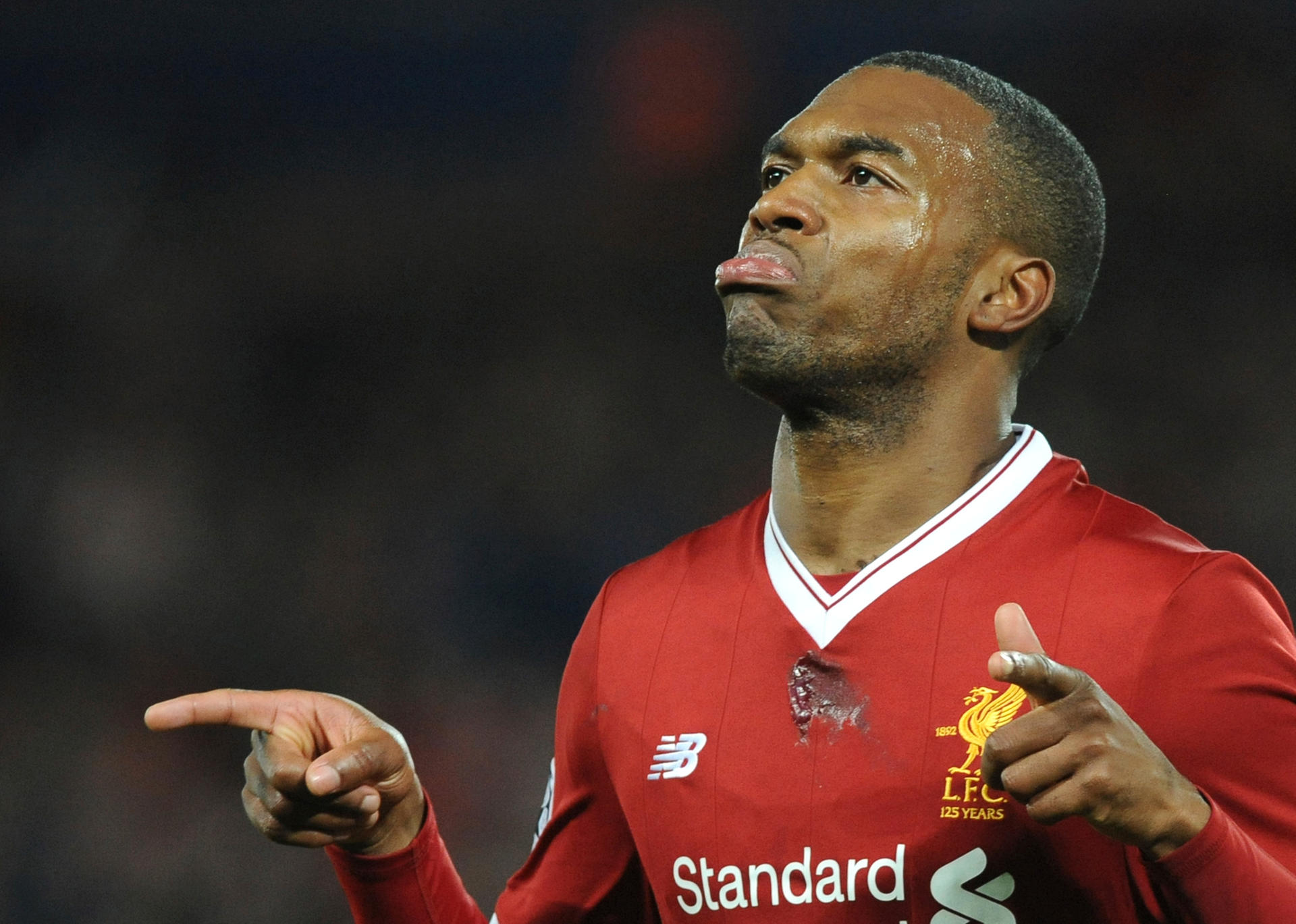 Nach einem Einbruch vermisst Daniel Sturridge seinen Hund.