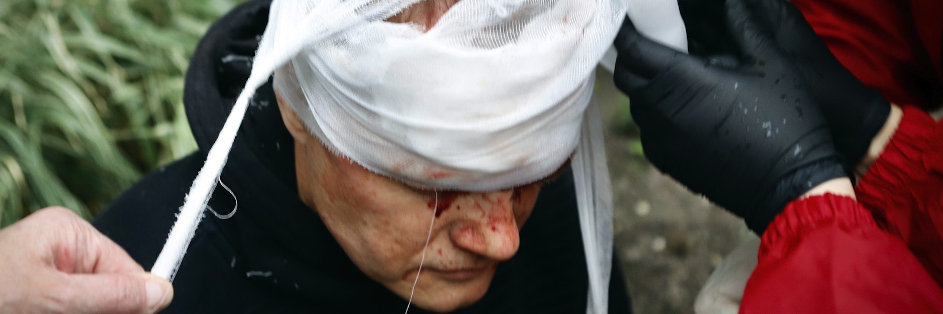 Demonstranten verbinden den blutig geschlagenen Kopf eines Protest-Teilnehmers.