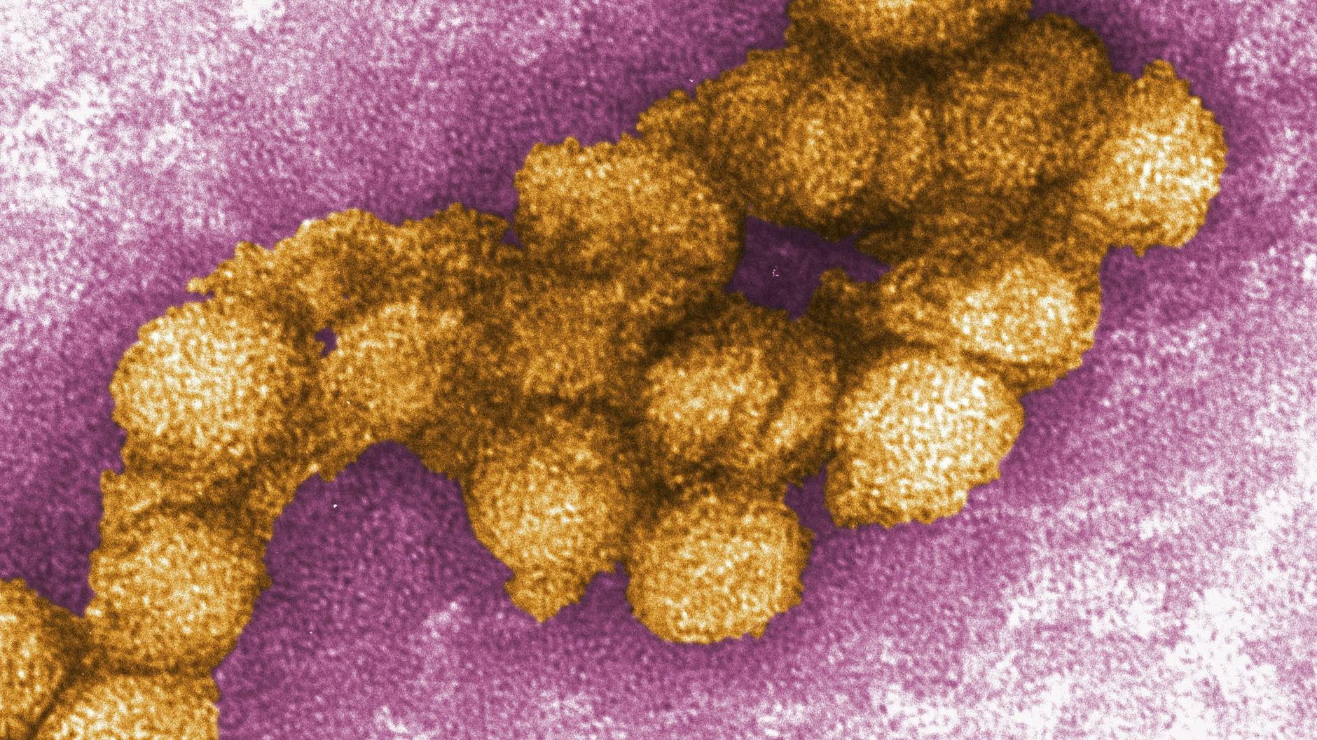 Das West-Nil-Virus unter dem Elektronenmikroskop.