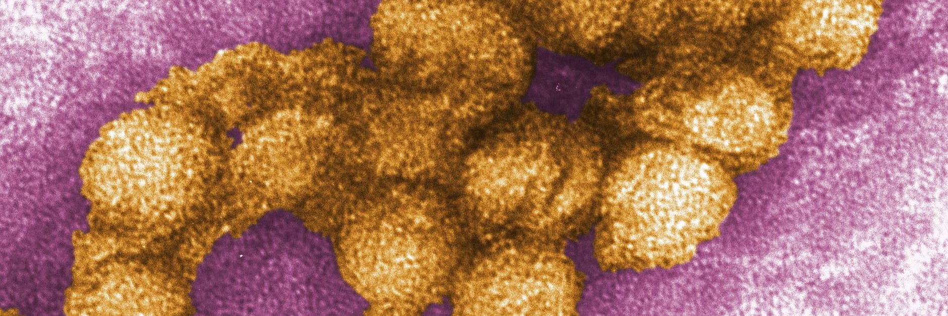 Das West-Nil-Virus unter dem Elektronenmikroskop.