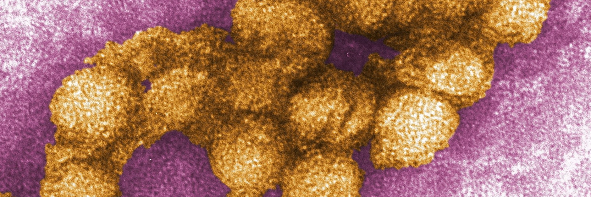 Das West-Nil-Virus unter dem Elektronenmikroskop.