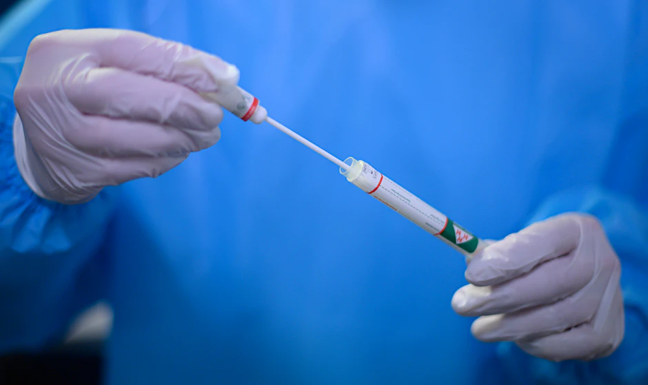 Ein Arzt hält in der Corona-Teststation für Urlaubsrückkehrer am Flughafen Dresden einen Coronavirus-Test in den Händen.&nbsp;