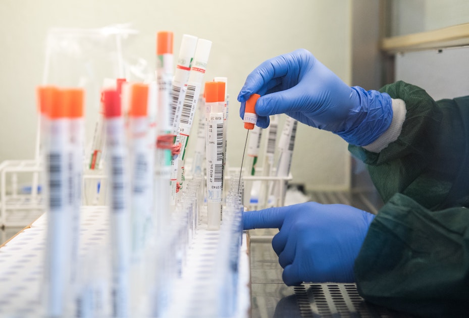 Dm verkauft jetzt Corona-Antikörper-Tests