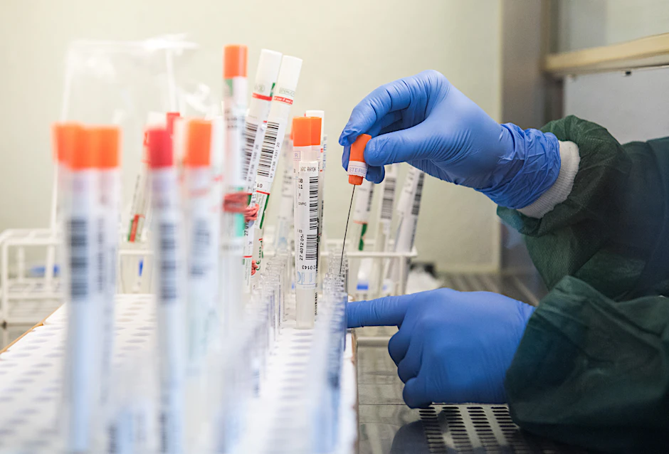 Tests auf das SARS-CoV-2-Virus (Symbolbild).