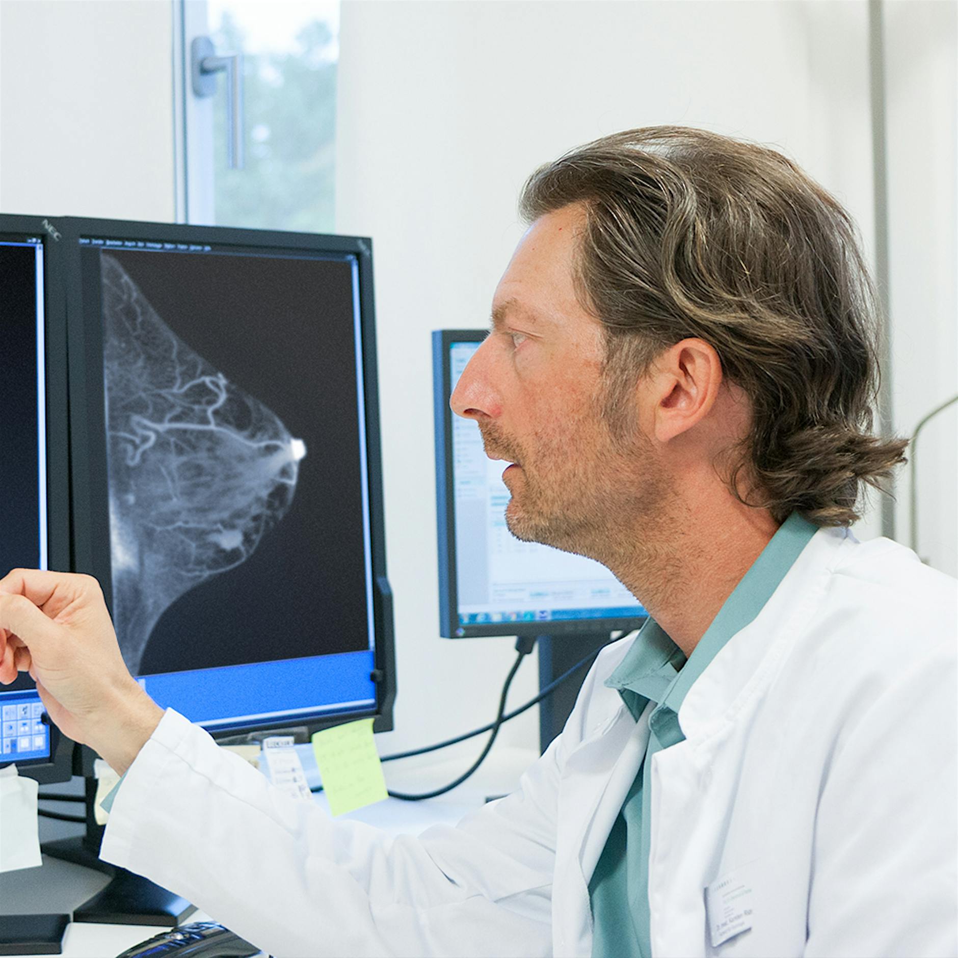 Früherkennung: Brustkrebs rechtzeitig entdecken