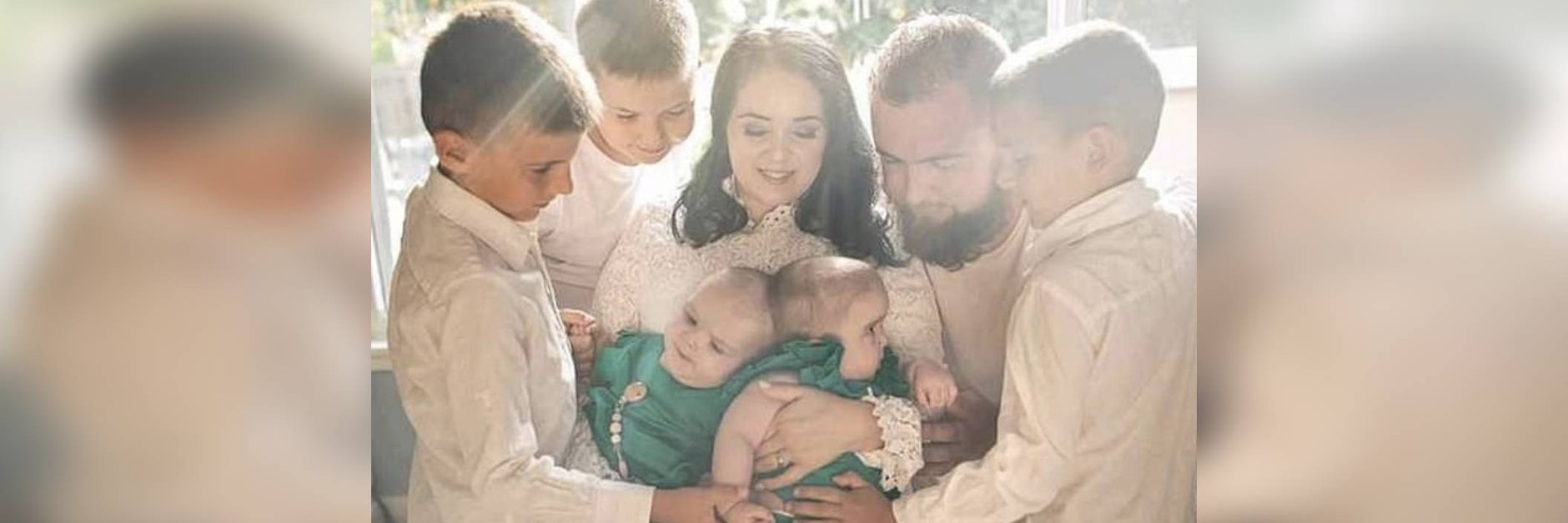 Die siamesischen Zwillinge Abigail und Micaela Bachinskiy vor der Operation mit ihrer Familie.