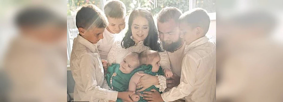 Die siamesischen Zwillinge Abigail und Micaela Bachinskiy vor der Operation mit ihrer Familie.