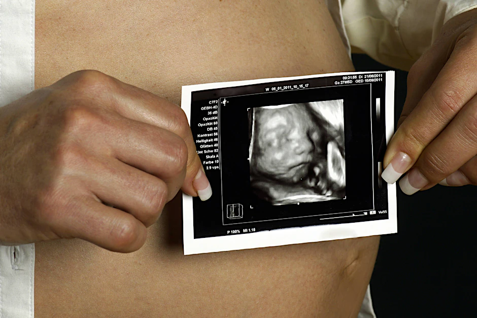 Eine Frau hält ein Ultraschallbild eines Baby in den Händen (Symbolbild).