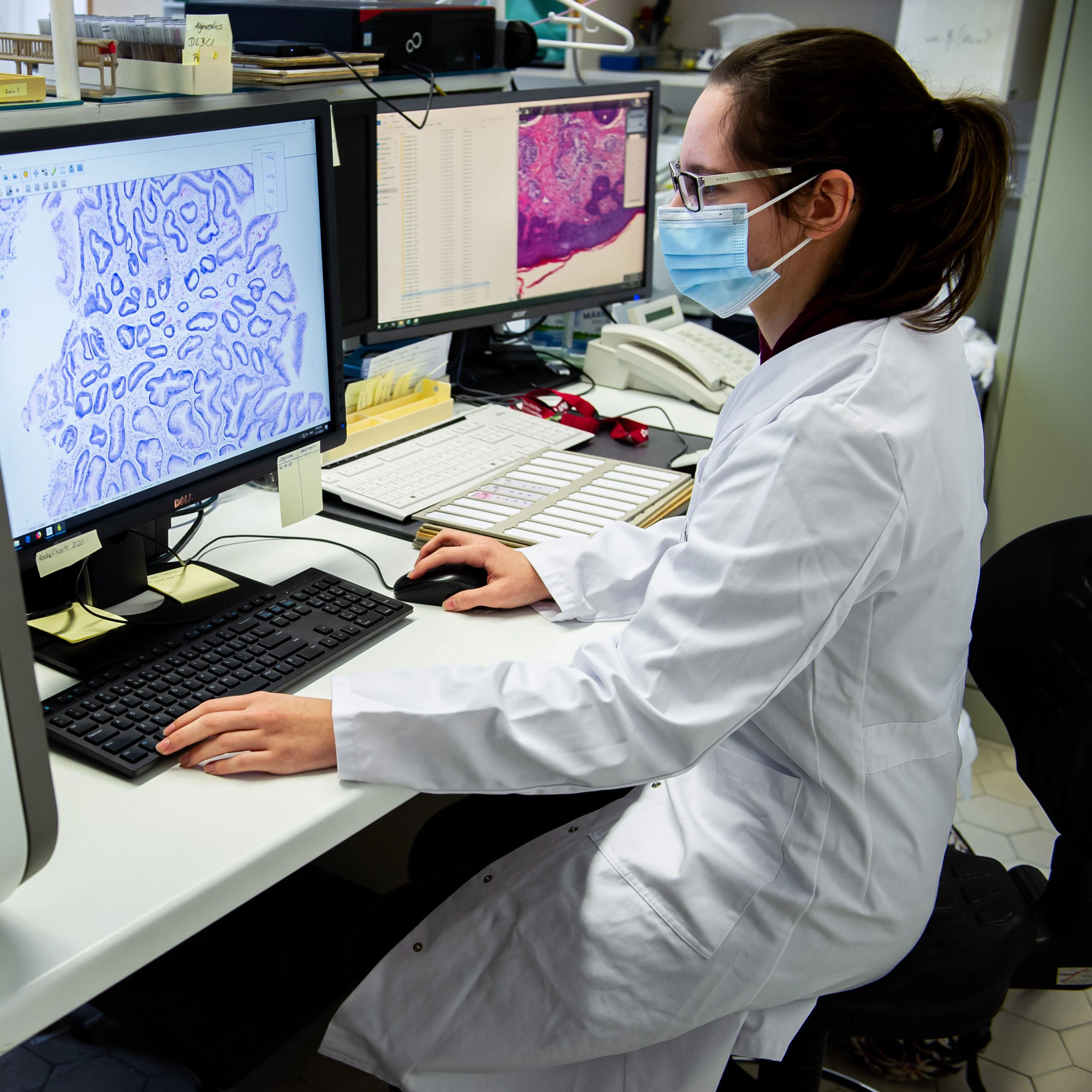 Die Gewebeprobe wird per Scanner digitalisiert. Anschließend kann die KI die Probe diagnostizieren.