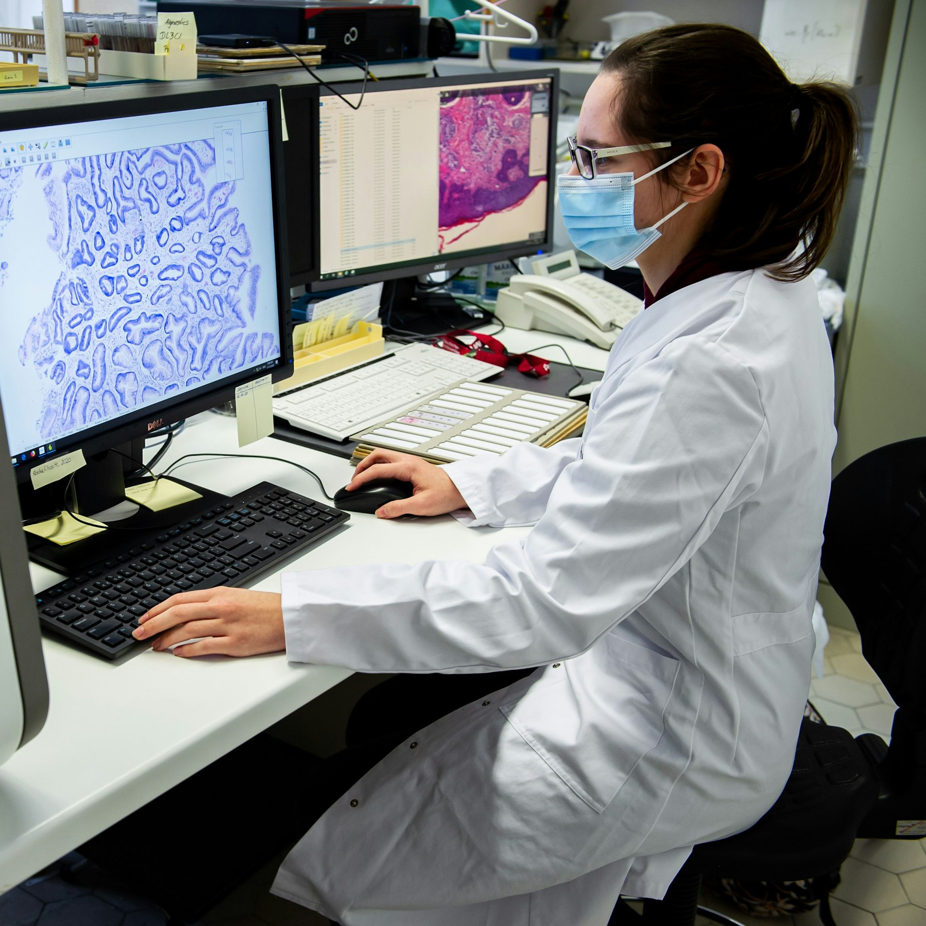 Die Gewebeprobe wird per Scanner digitalisiert. Anschließend kann die KI die Probe diagnostizieren.