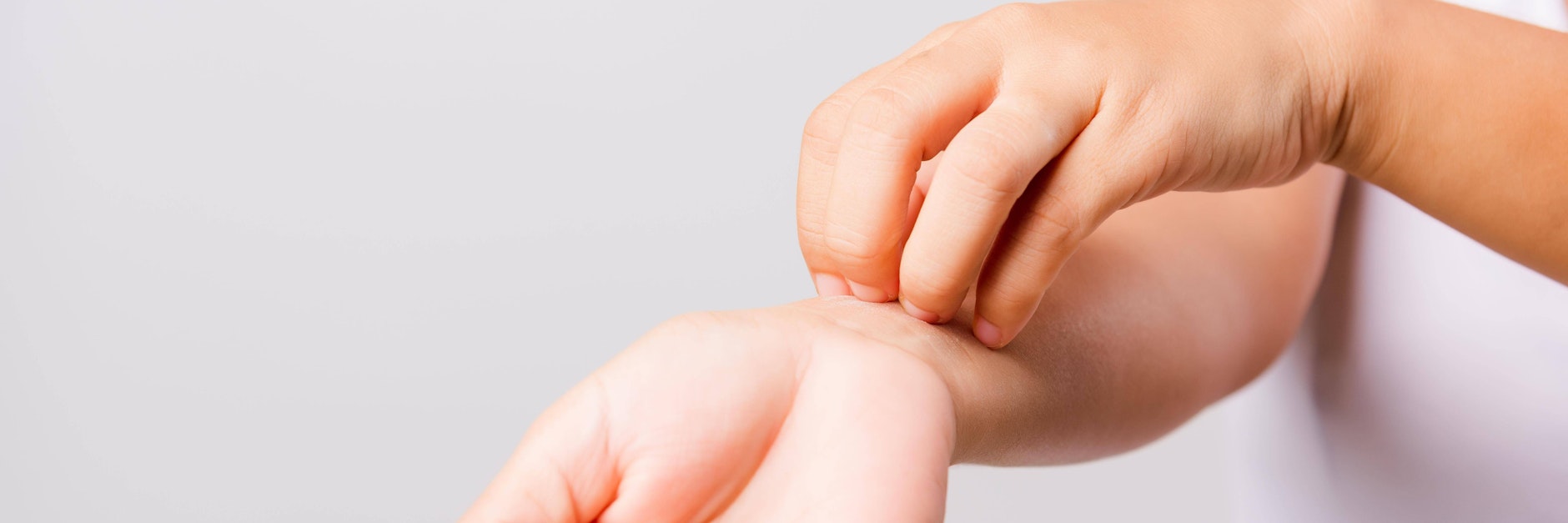 Die Chemikalien lösen Juckreiz aus, auch Rötungen und Bläschen sind häufig zu beobachten.