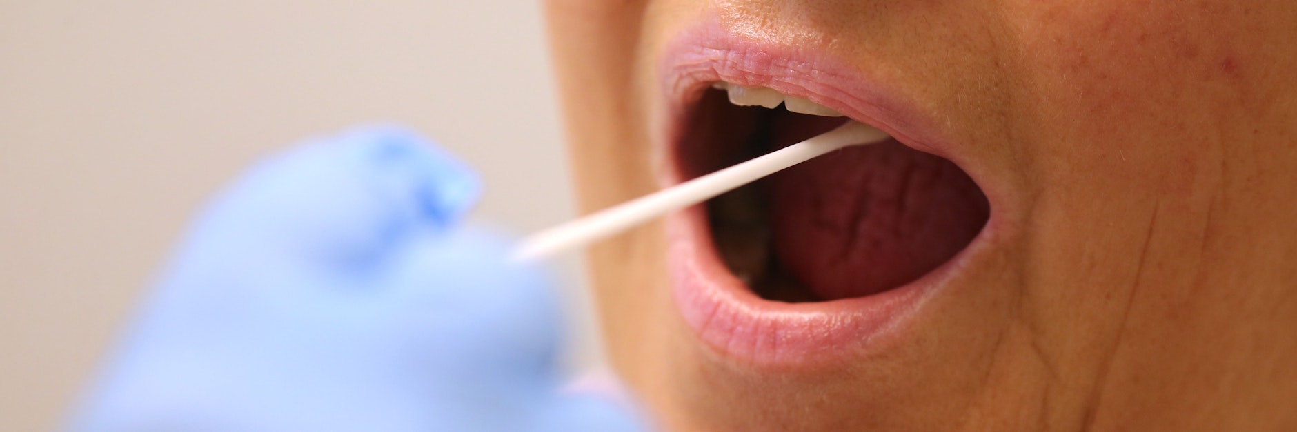 Mit einem langen Abstrichtupfer, das dem Testkit beiliegt, entnimmt man sich selbst einen Abstrich der Rachenschleimhaut.