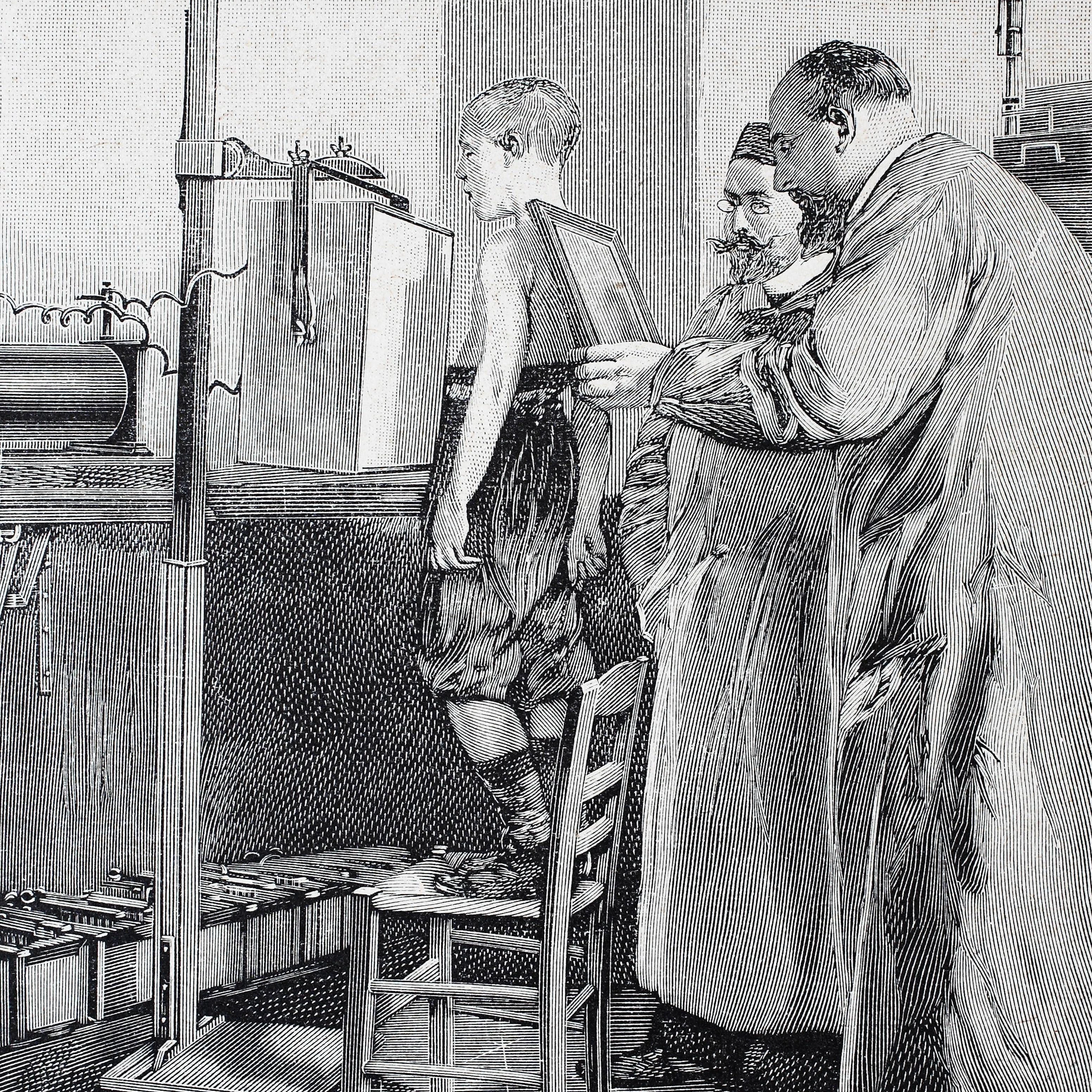 Diese historische Darstellung von 1890 zeigt einen jungen Patienten, wie er mit Röntgenstrahlen untersucht wird.&nbsp;