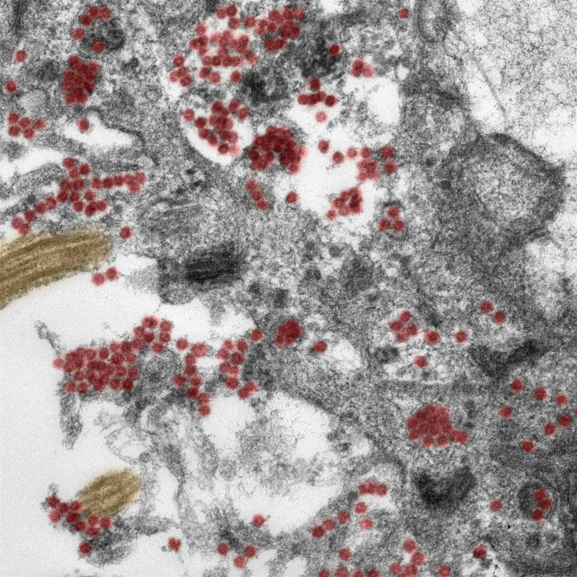 Berliner Forscher rekonstruieren Route des Coronavirus ins Gehirn