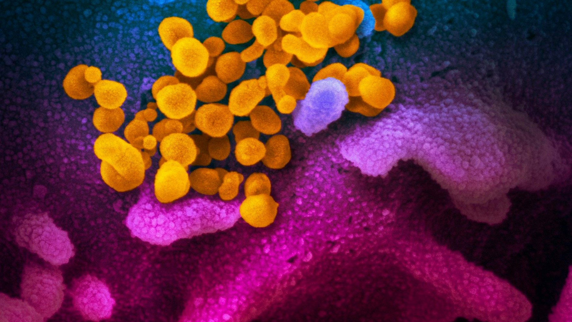 Elektronenmikroskop-Aufnahme von Sars-CoV-2 (gelb) in einer Zellkultur. 