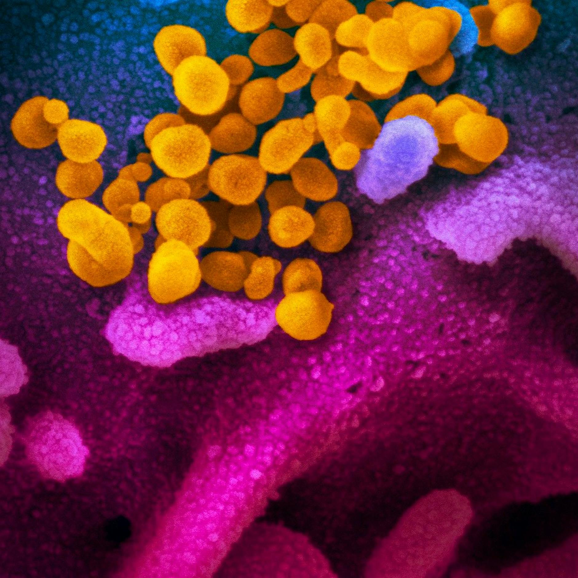 Wie lange ist Covid-19 ansteckend?