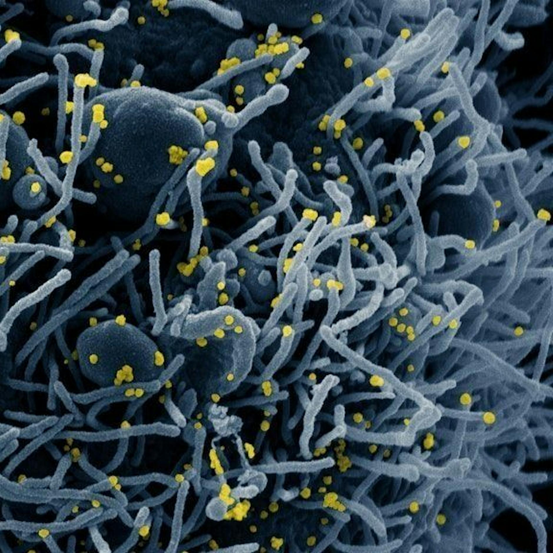 Corona in Berlin: 1123 Neuinfektionen, 17 weitere Todesfälle