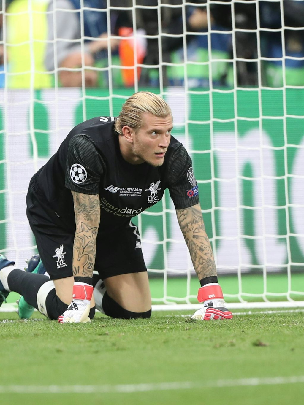 Bei Loris Karius hätte ich keine Zahnschmerzen