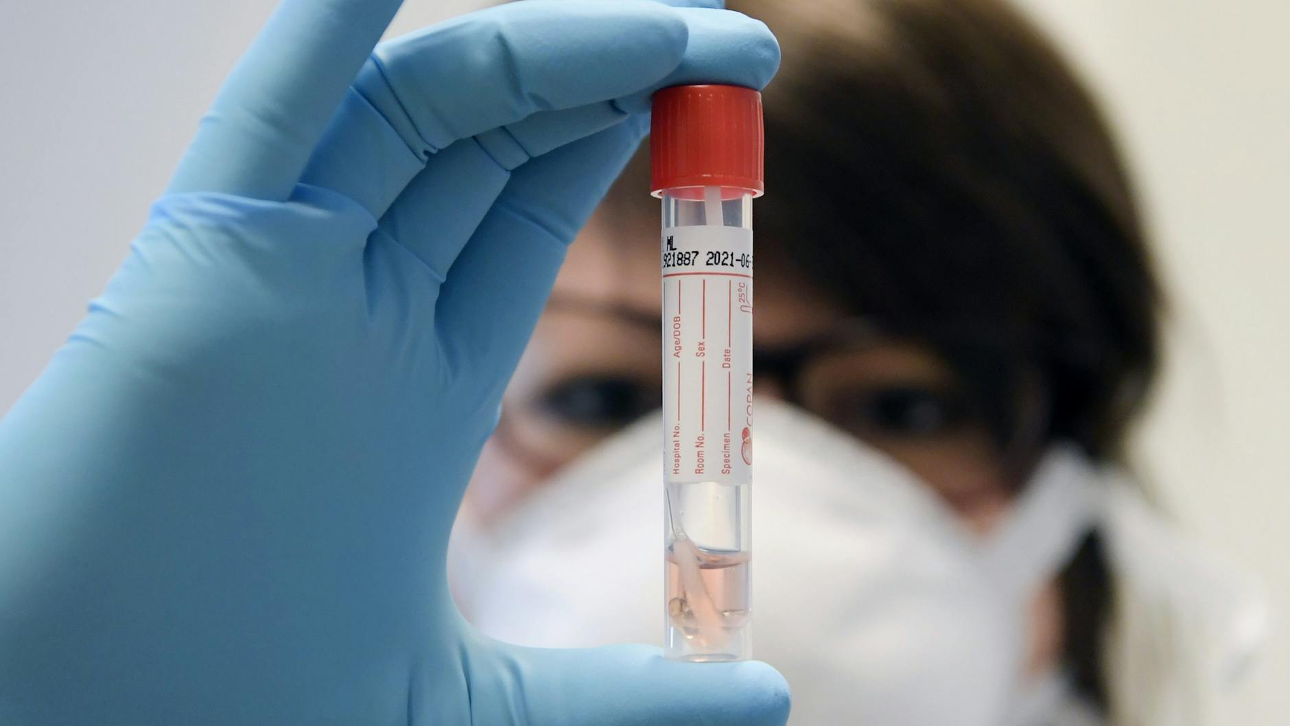 In Berlin sollen ein Jahr lang Kinder regelmäßig getestet werden. 