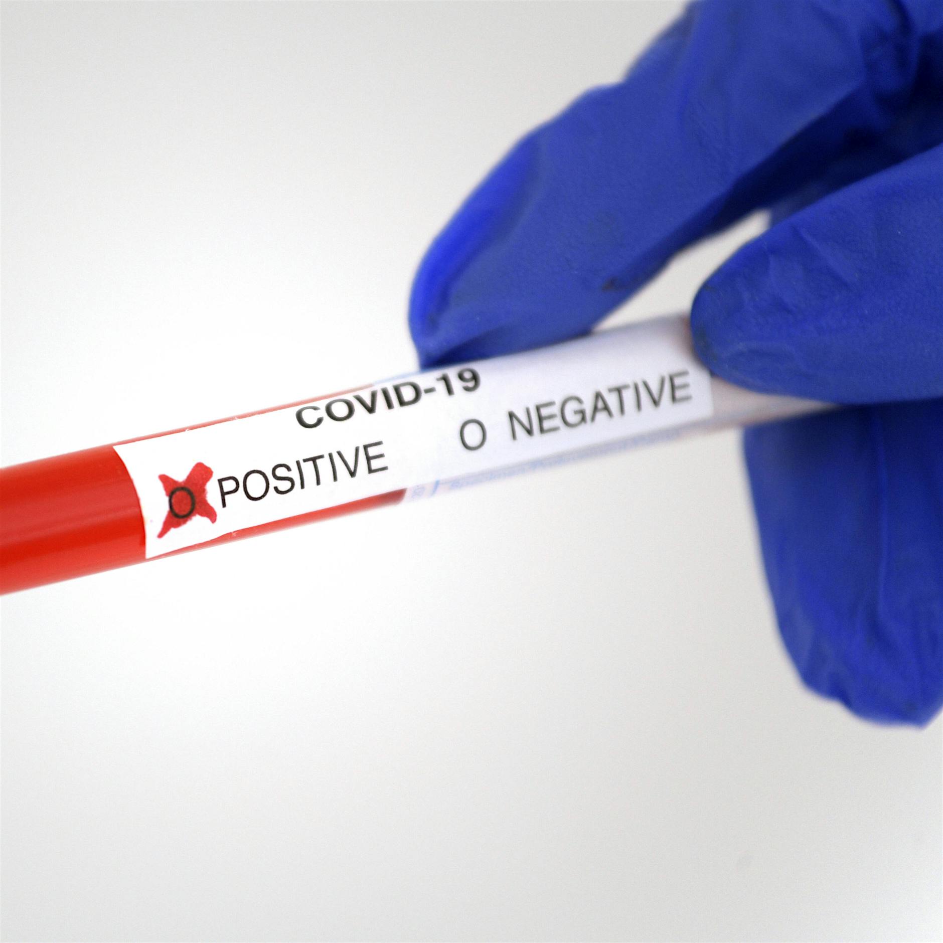 Mennoniten-Gemeinde muss in Quarantäne: Rund 1000 Menschen betroffen