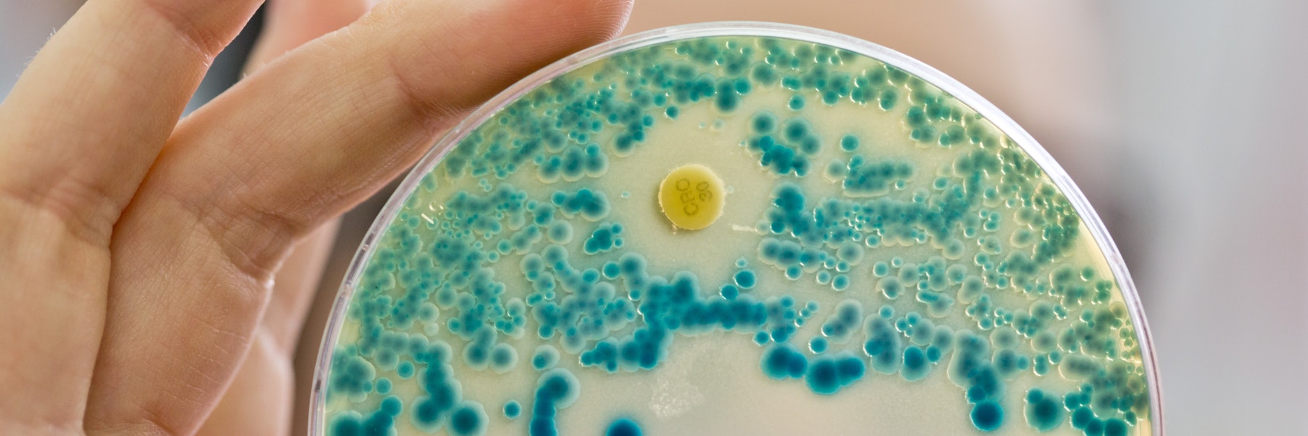 Resistente Keime - weltweit sterben jedes Jahr 700.000 Menschen wegen dieser Erreger.