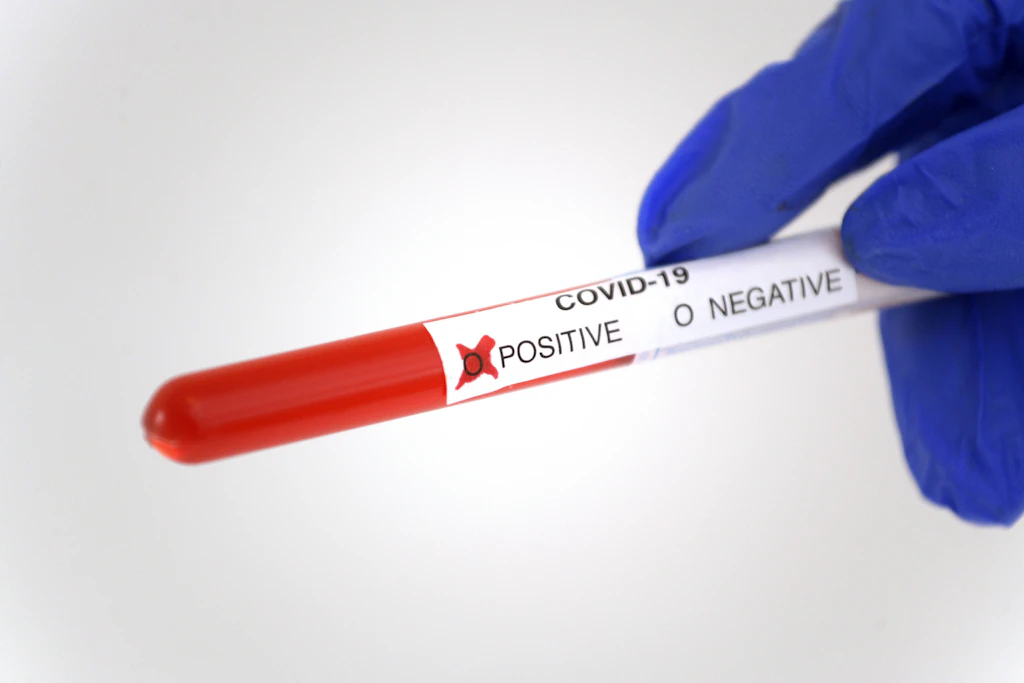 Coronavirus: Infektionen nach Sexparty in Mitte