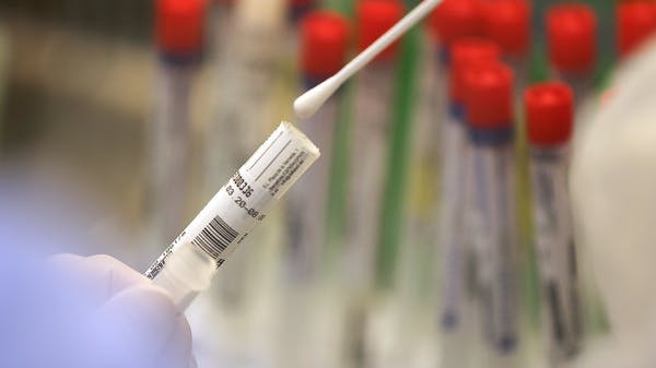 Im Labor werden zum Nachweis einer Infektion Abstriche aus dem Nasen-Rachen-Raum auf das Sars-CoV-2-Virus getestet.
