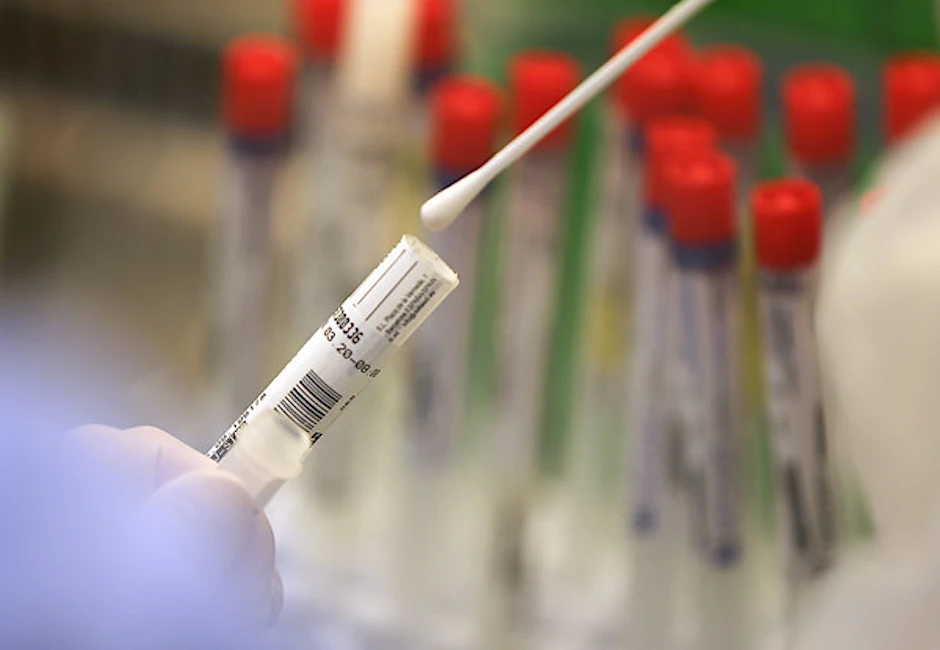 Im Labor werden zum Nachweis einer Infektion Abstriche aus dem Nasen-Rachen-Raum auf das Sars-CoV-2-Virus getestet.