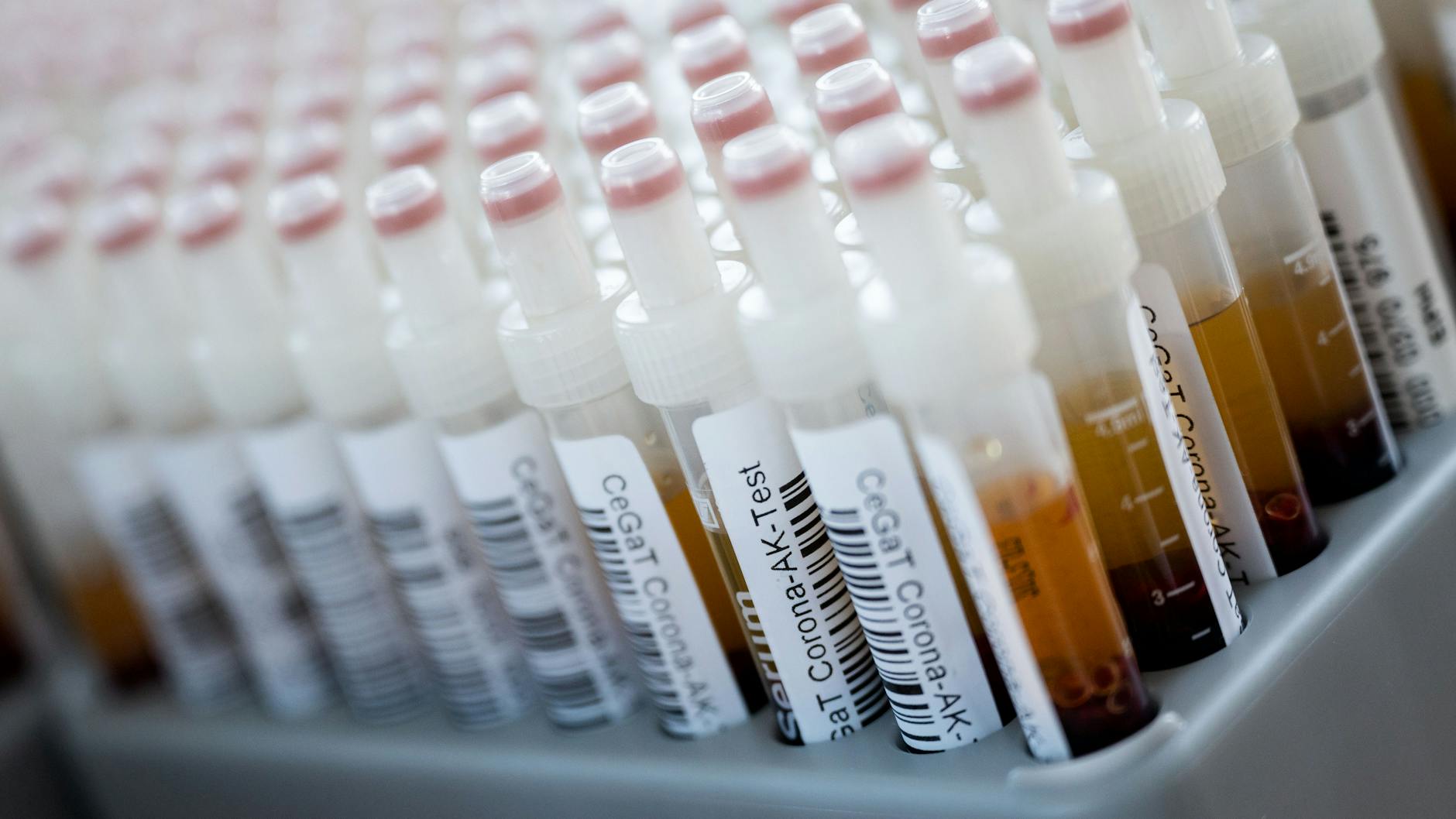 Blutproben für einen Corona-Antikörper-Test.