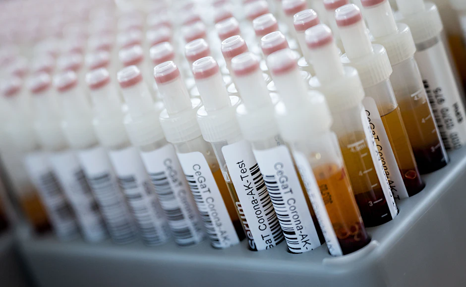 Blutproben für einen Corona-Antikörper-Test.