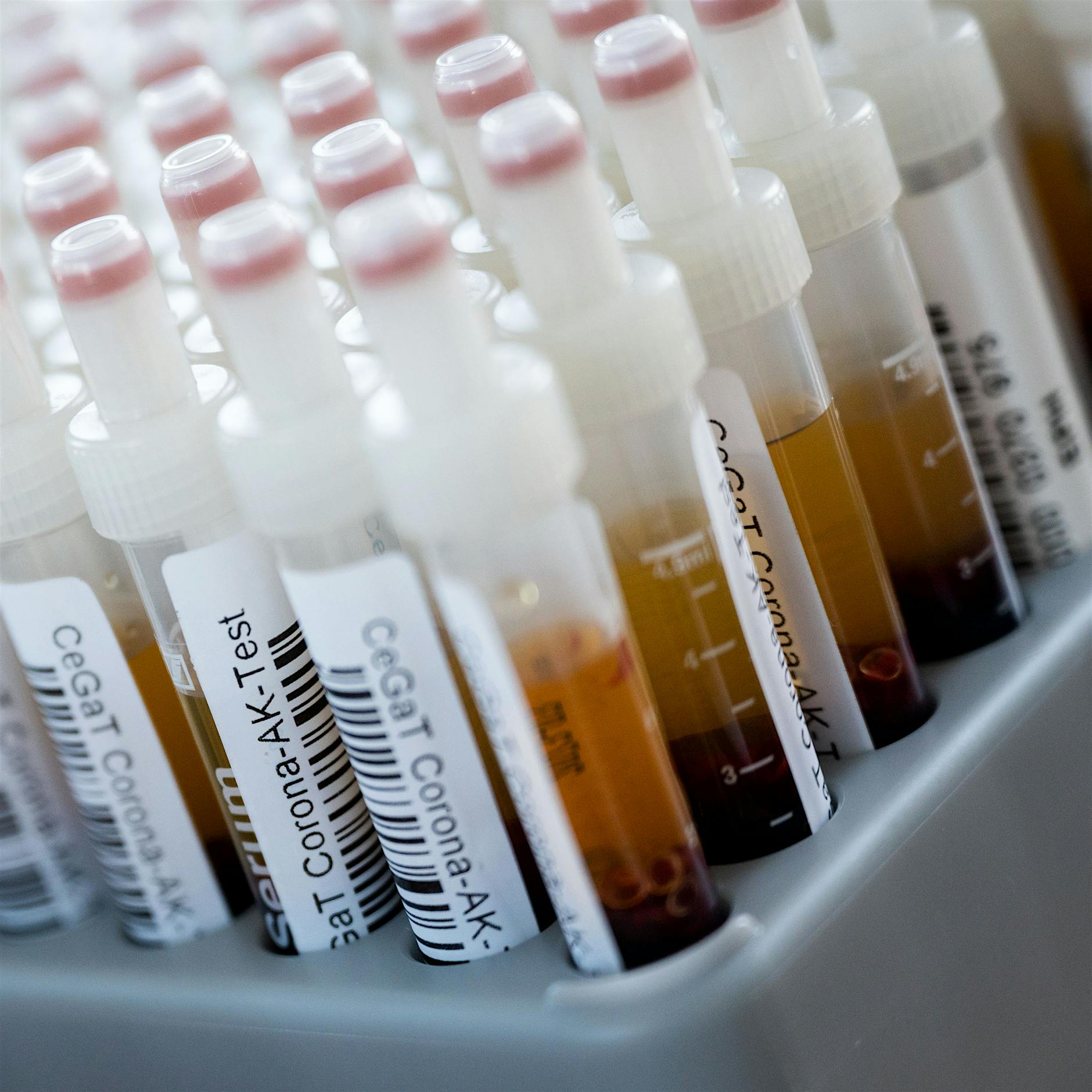 Antikörper im Blut sagen nur wenig über die Immunität nach einer Corona-Infektion aus